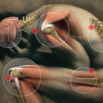 Trigger Point e Dolore Muscoloscheletrico