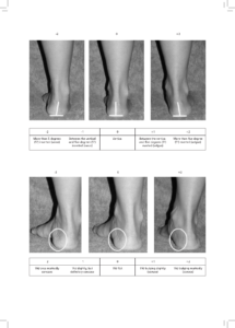 foot posture index italiano