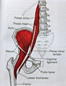 lesione muscolo ileopsoas 2