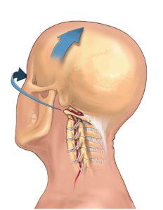 Vertebral Artery