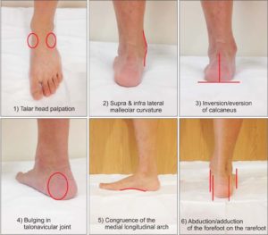 foot posture index italiano